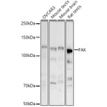 Western Blot - Anti-FAK Antibody (A88000) - Antibodies.com