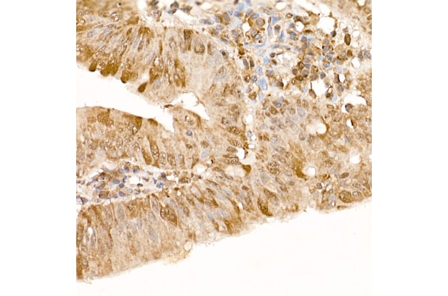Immunohistochemistry - Anti-FAK Antibody (A88000) - Antibodies.com
