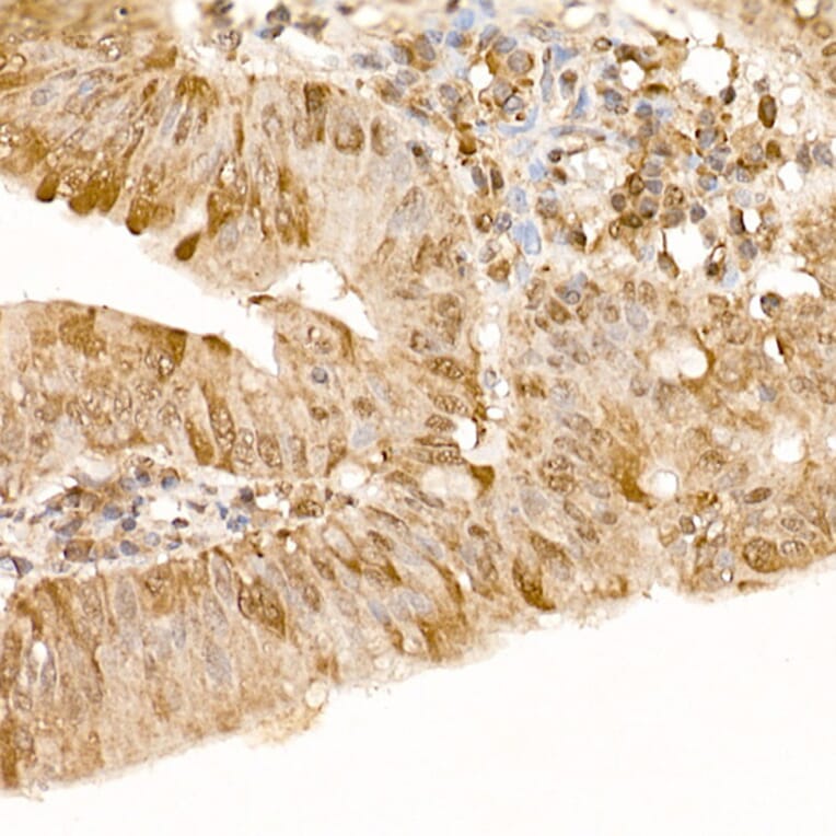 Immunohistochemistry - Anti-FAK Antibody (A88000) - Antibodies.com