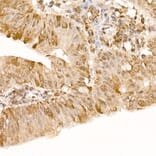 Immunohistochemistry - Anti-FAK Antibody (A88000) - Antibodies.com