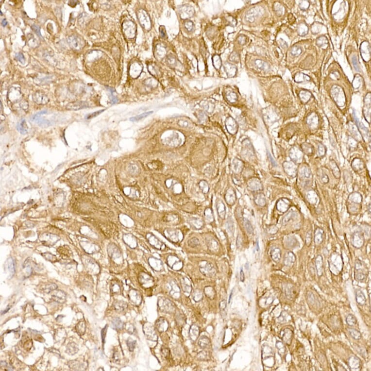 Immunohistochemistry - Anti-FAK Antibody (A88000) - Antibodies.com