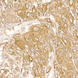Immunohistochemistry - Anti-FAK Antibody (A88000) - Antibodies.com