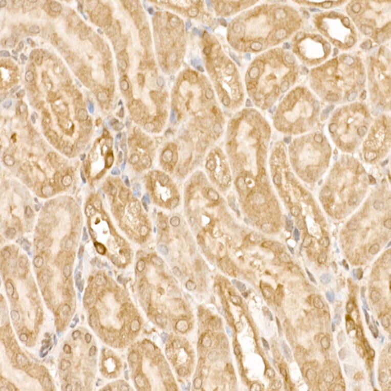 Immunohistochemistry - Anti-FAK Antibody (A88000) - Antibodies.com