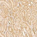 Immunohistochemistry - Anti-FAK Antibody (A88000) - Antibodies.com