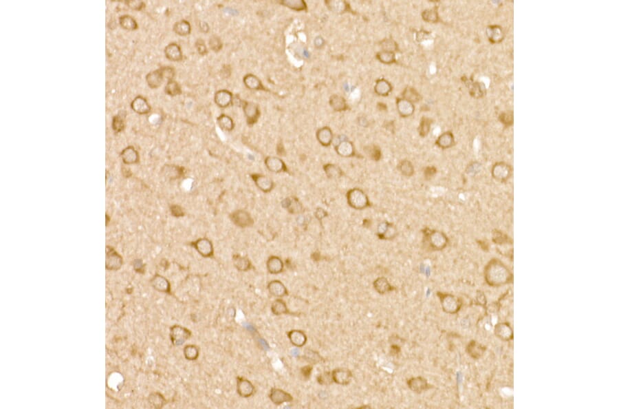 Immunohistochemistry - Anti-FAK Antibody (A88000) - Antibodies.com