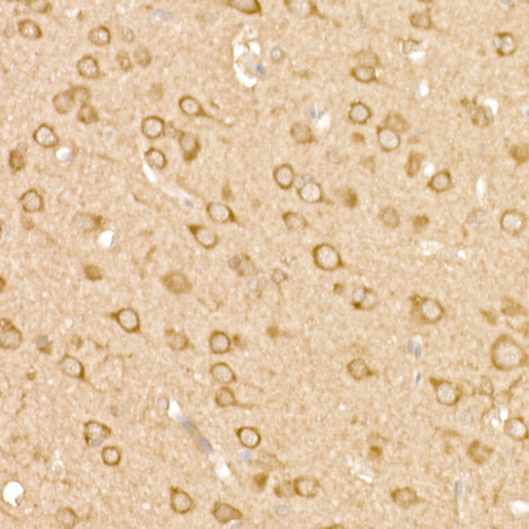 Immunohistochemistry - Anti-FAK Antibody (A88000) - Antibodies.com