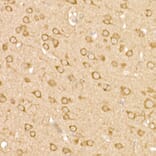Immunohistochemistry - Anti-FAK Antibody (A88000) - Antibodies.com