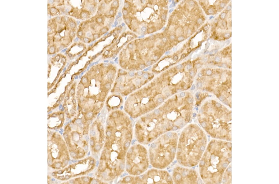 Immunohistochemistry - Anti-FAK Antibody (A88000) - Antibodies.com