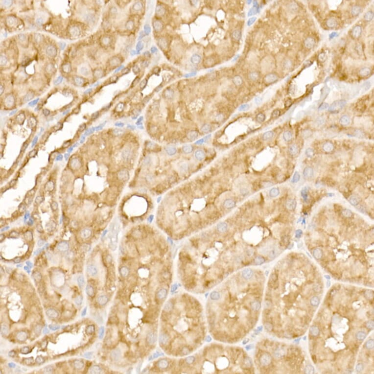 Immunohistochemistry - Anti-FAK Antibody (A88000) - Antibodies.com