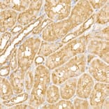 Immunohistochemistry - Anti-FAK Antibody (A88000) - Antibodies.com