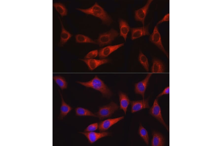 Immunofluorescence - Anti-FAK Antibody (A88000) - Antibodies.com