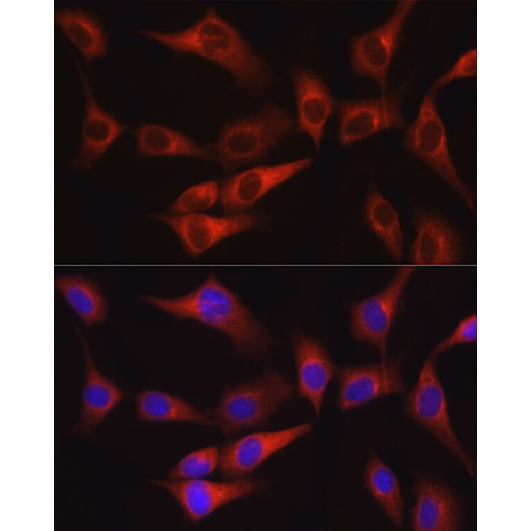 Immunofluorescence - Anti-FAK Antibody (A88000) - Antibodies.com