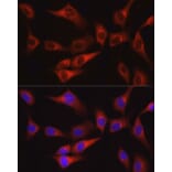 Immunofluorescence - Anti-FAK Antibody (A88000) - Antibodies.com
