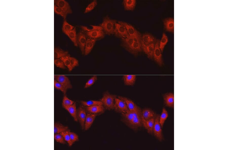 Immunofluorescence - Anti-FAK Antibody (A88000) - Antibodies.com