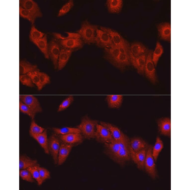 Immunofluorescence - Anti-FAK Antibody (A88000) - Antibodies.com