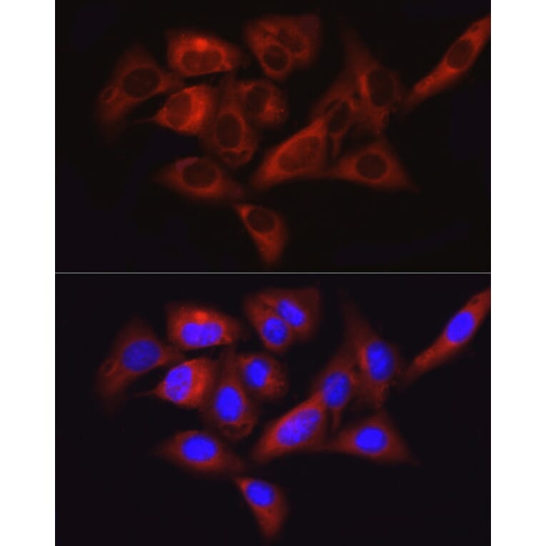 Immunofluorescence - Anti-FAK Antibody (A88000) - Antibodies.com