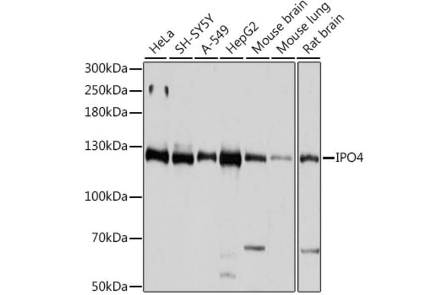 Western Blot - Anti-Importin4/Imp4 Antibody (A88001) - Antibodies.com