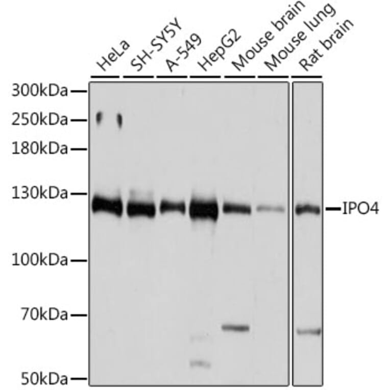 Western Blot - Anti-Importin4/Imp4 Antibody (A88001) - Antibodies.com
