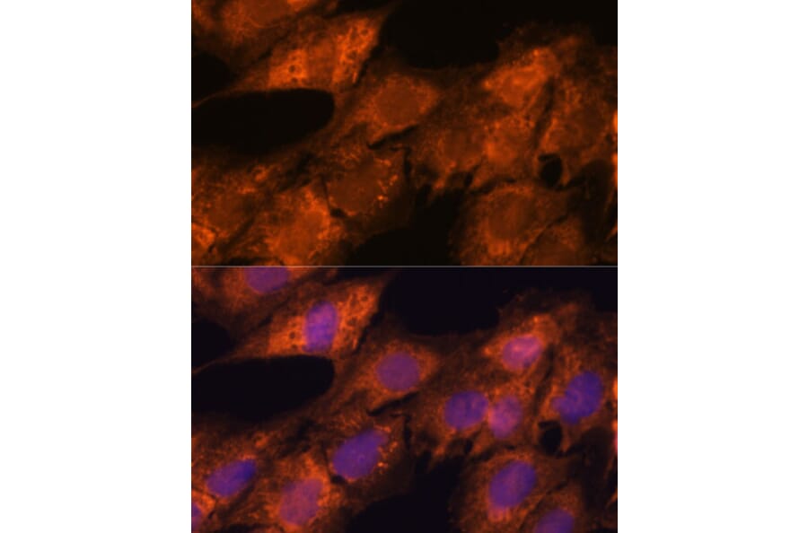 Immunofluorescence - Anti-Importin4/Imp4 Antibody (A88001) - Antibodies.com