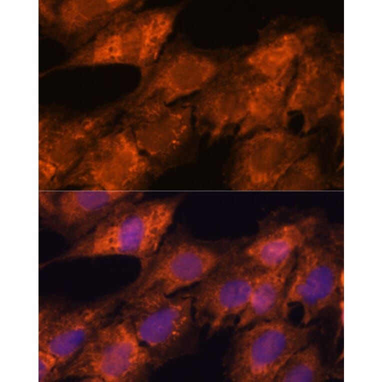 Immunofluorescence - Anti-Importin4/Imp4 Antibody (A88001) - Antibodies.com
