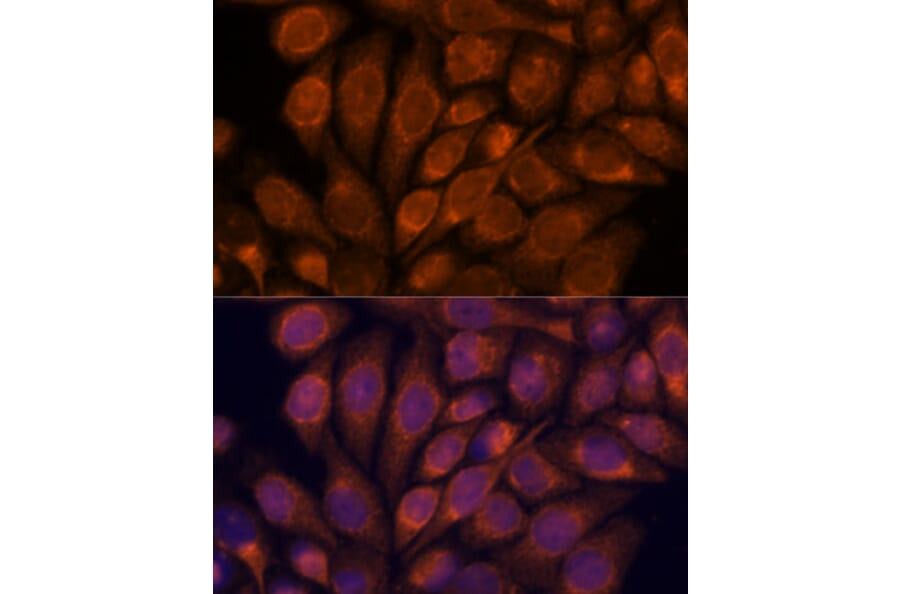 Immunofluorescence - Anti-Importin4/Imp4 Antibody (A88001) - Antibodies.com