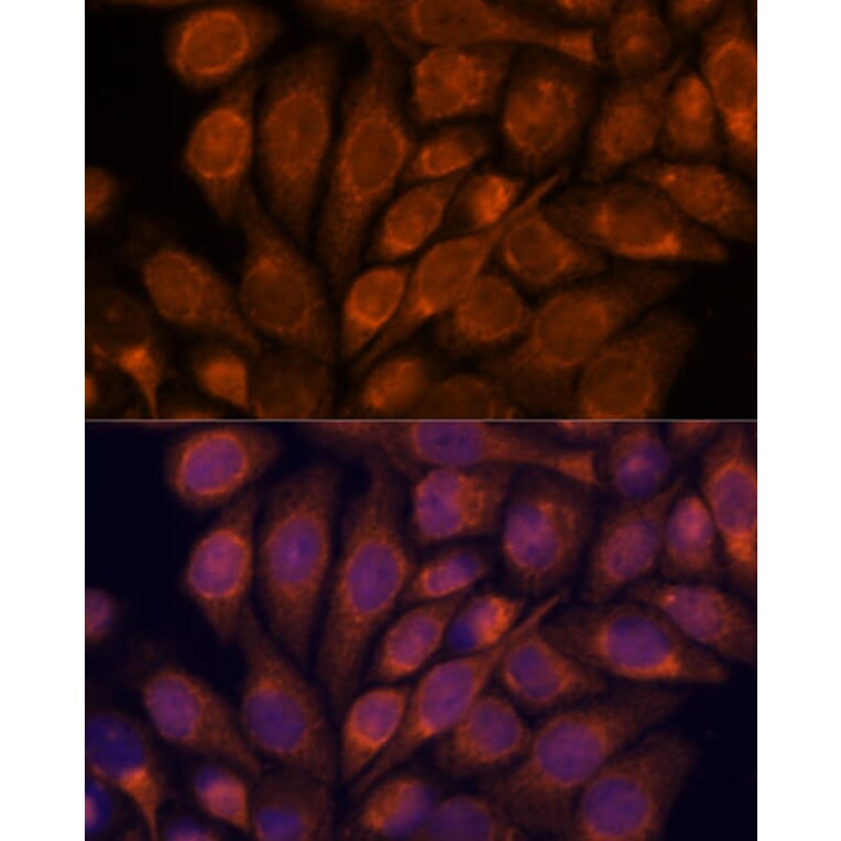 Immunofluorescence - Anti-Importin4/Imp4 Antibody (A88001) - Antibodies.com