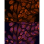 Immunofluorescence - Anti-Importin4/Imp4 Antibody (A88001) - Antibodies.com