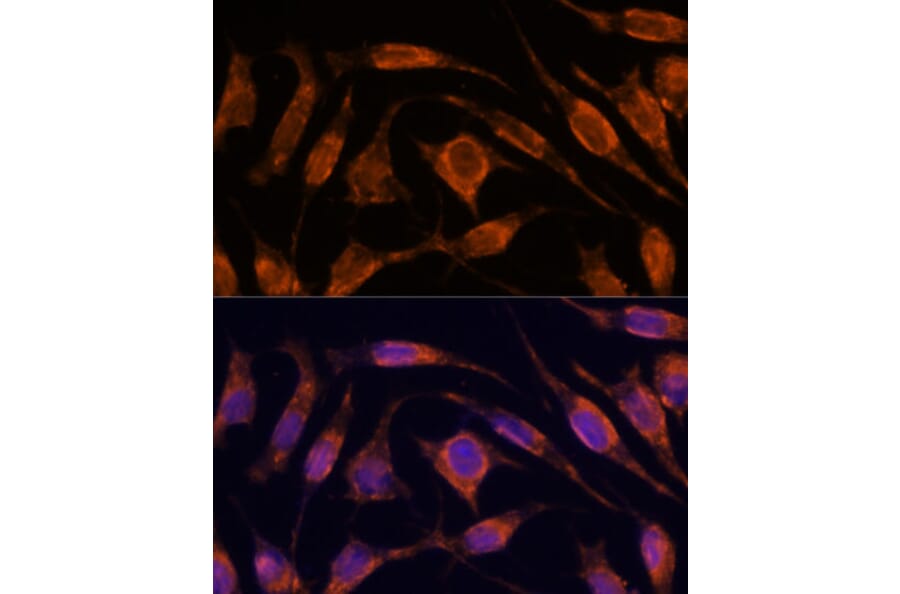 Immunofluorescence - Anti-Importin4/Imp4 Antibody (A88001) - Antibodies.com