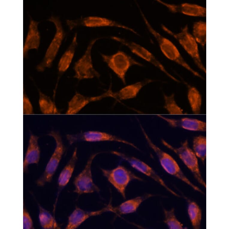 Immunofluorescence - Anti-Importin4/Imp4 Antibody (A88001) - Antibodies.com