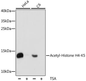 Western Blot - Anti-Histone H4 (acetyl Lys5) Antibody (A88002) - Antibodies.com