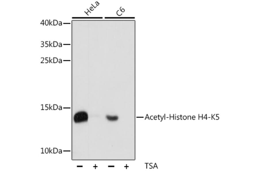 Western Blot - Anti-Histone H4 (acetyl Lys5) Antibody (A88002) - Antibodies.com