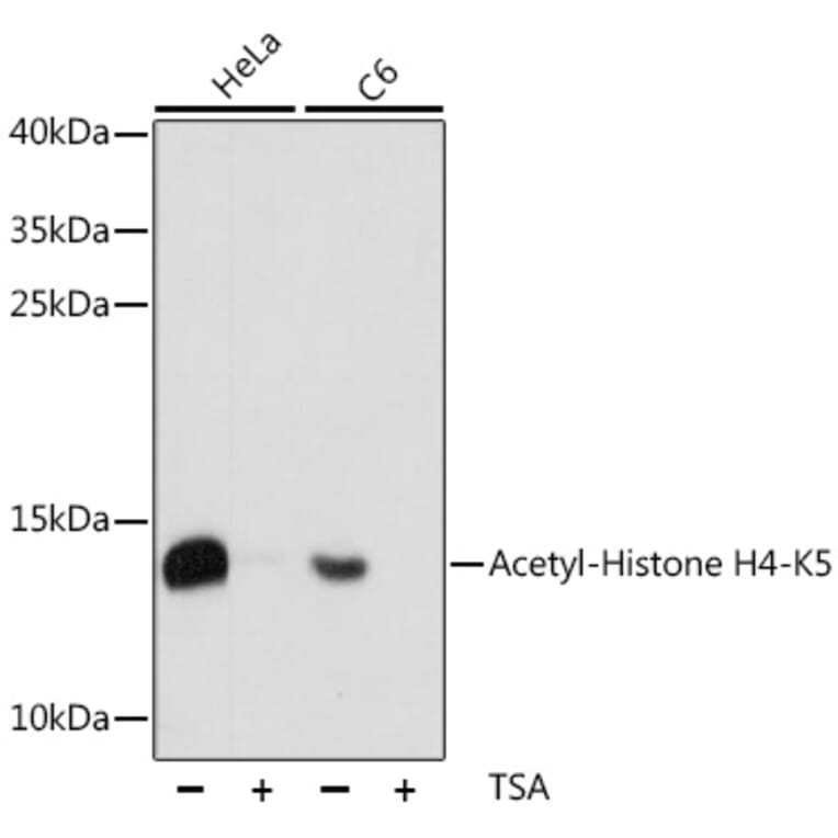 Western Blot - Anti-Histone H4 (acetyl Lys5) Antibody (A88002) - Antibodies.com