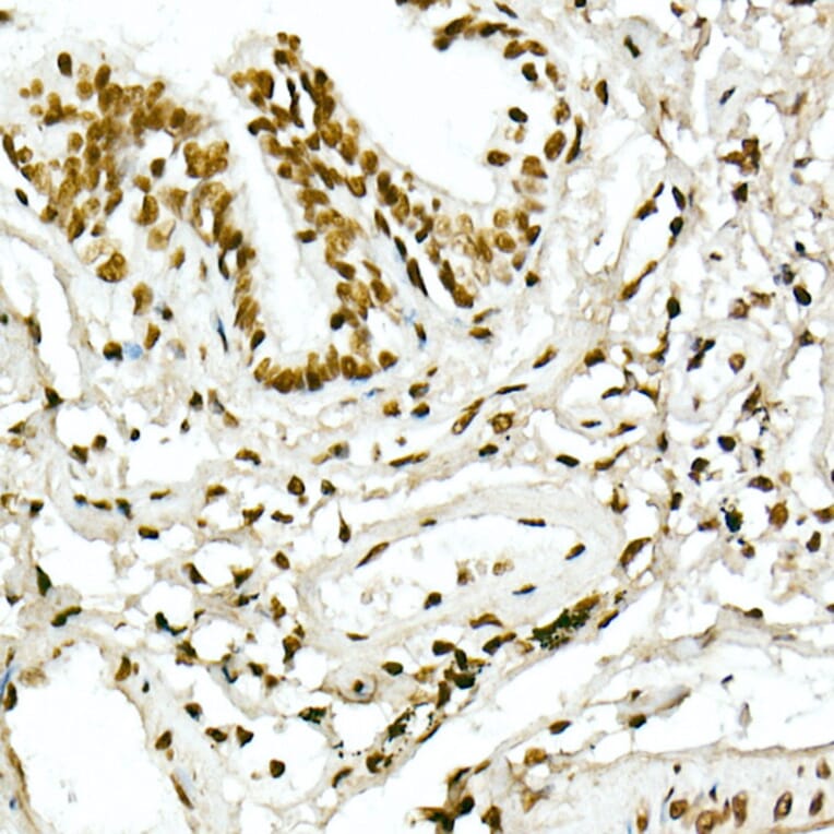 Immunohistochemistry - Anti-Histone H4 (acetyl Lys5) Antibody (A88002) - Antibodies.com