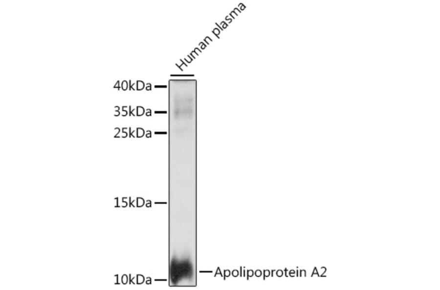 Western Blot - Anti-Apolipoprotein A II/ApoA-II Antibody (A88003) - Antibodies.com