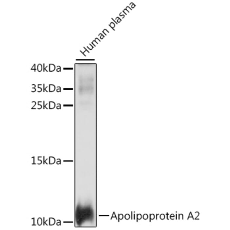 Western Blot - Anti-Apolipoprotein A II/ApoA-II Antibody (A88003) - Antibodies.com