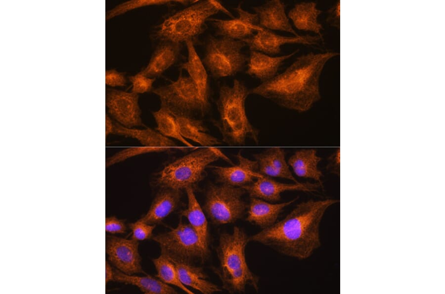 Immunofluorescence - Anti-Apolipoprotein A II/ApoA-II Antibody (A88003) - Antibodies.com
