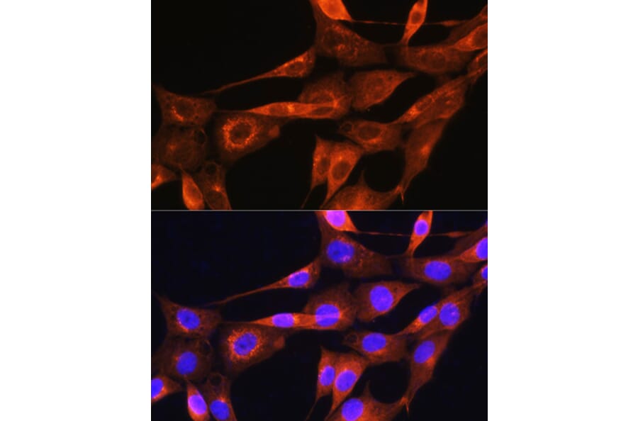 Immunofluorescence - Anti-Apolipoprotein A II/ApoA-II Antibody (A88003) - Antibodies.com