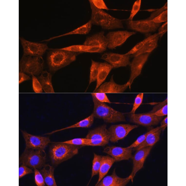 Immunofluorescence - Anti-Apolipoprotein A II/ApoA-II Antibody (A88003) - Antibodies.com