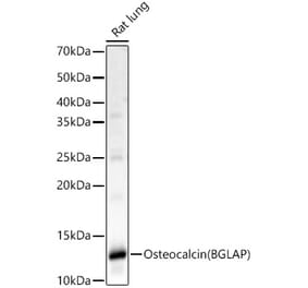 Western Blot - Anti-Osteocalcin Antibody (A88004) - Antibodies.com