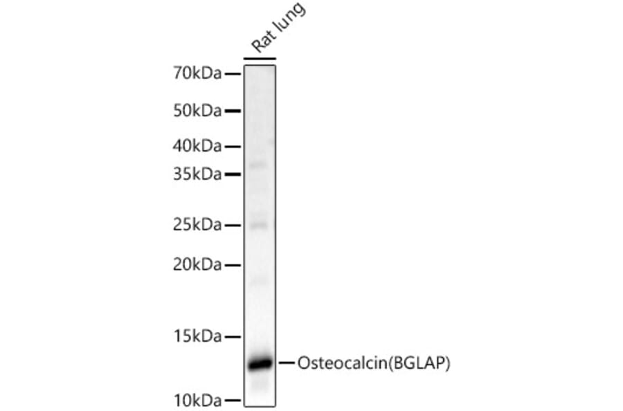 Western Blot - Anti-Osteocalcin Antibody (A88004) - Antibodies.com