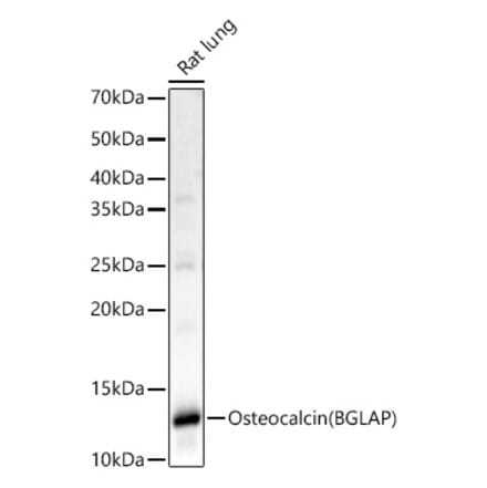 Western Blot - Anti-Osteocalcin Antibody (A88004) - Antibodies.com
