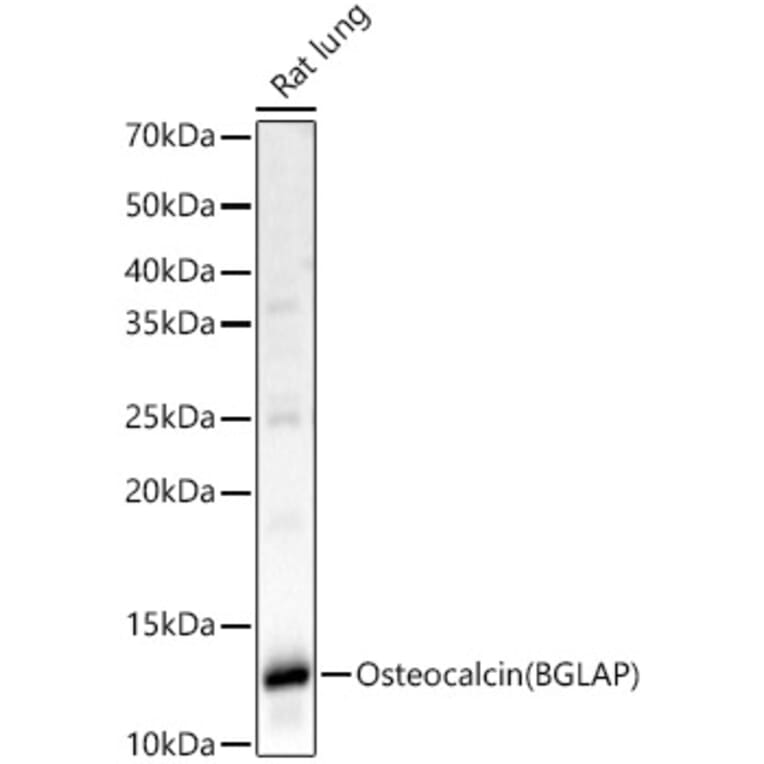 Western Blot - Anti-Osteocalcin Antibody (A88004) - Antibodies.com