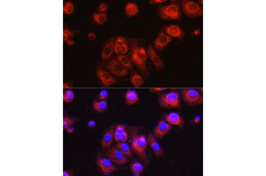 Immunofluorescence - Anti-Osteocalcin Antibody (A88004) - Antibodies.com