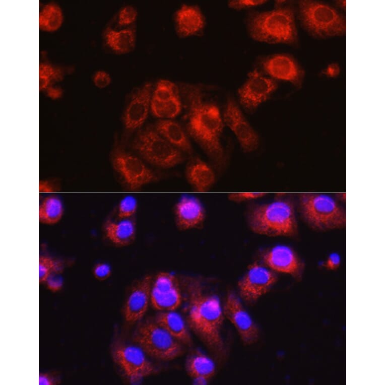 Immunofluorescence - Anti-Osteocalcin Antibody (A88004) - Antibodies.com