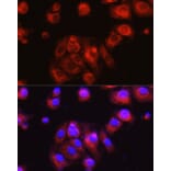 Immunofluorescence - Anti-Osteocalcin Antibody (A88004) - Antibodies.com