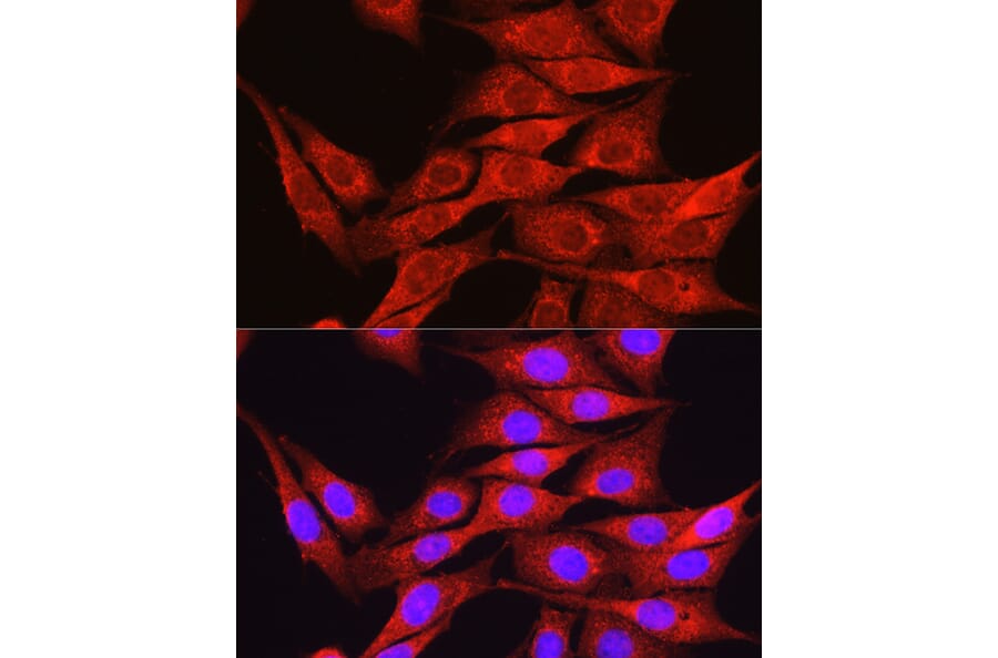 Immunofluorescence - Anti-Osteocalcin Antibody (A88004) - Antibodies.com