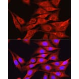 Immunofluorescence - Anti-Osteocalcin Antibody (A88004) - Antibodies.com