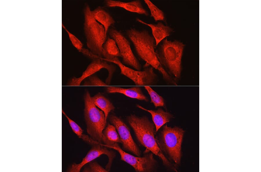 Immunofluorescence - Anti-Osteocalcin Antibody (A88004) - Antibodies.com