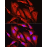 Immunofluorescence - Anti-Osteocalcin Antibody (A88004) - Antibodies.com