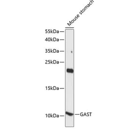Western Blot - Anti-Gastrin Antibody (A88005) - Antibodies.com